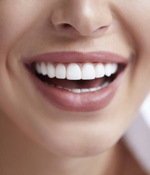 Woman sharing smile after gum grafting