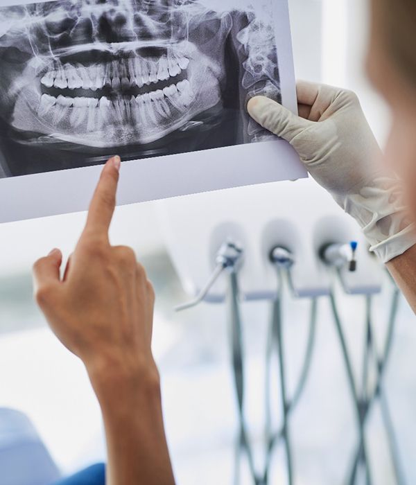 Patient and dentist looking at X-ray for dental implants in Colorado Springs