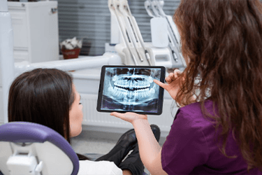 Surgical Extractions