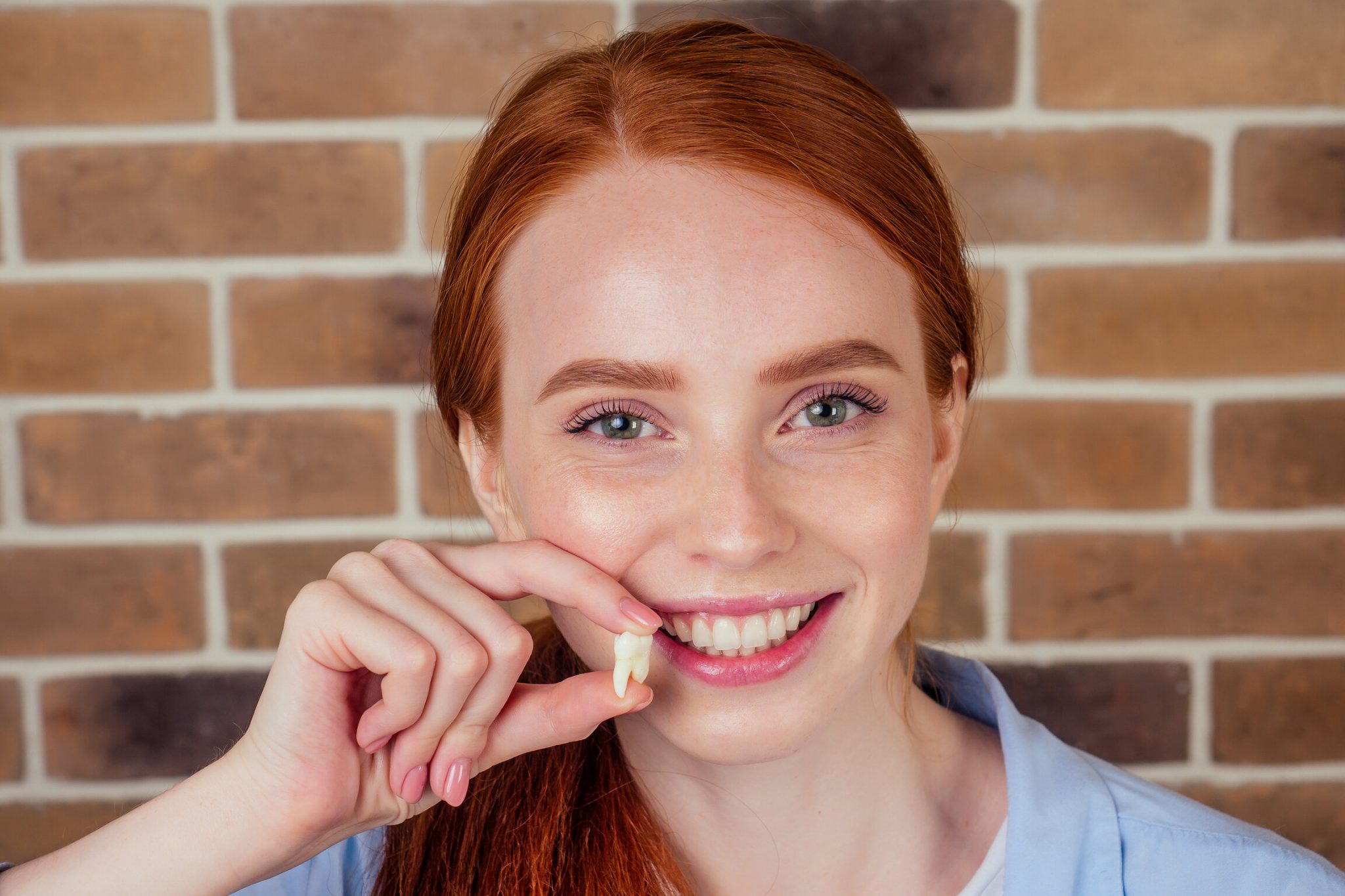 Wisdom Teeth Often Get Removed. So Why Do We Have Them?