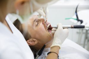 Dentist measuring woman's gum pocket depth with periodontal probe