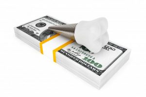 dental implant laying on a stack of cash 