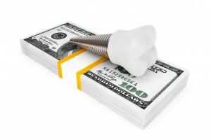 dental implant laying on a stack of cash
