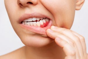 a patient inspecting their gums